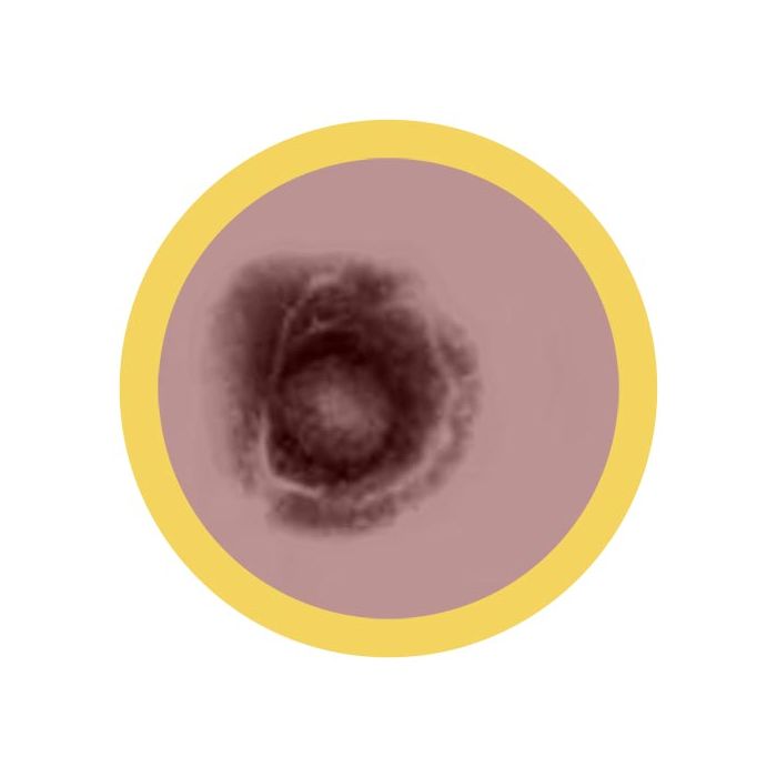 Chickenpox microbial