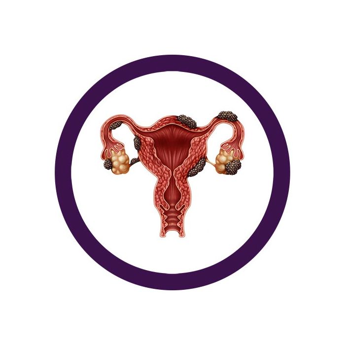 Endometriosis real image