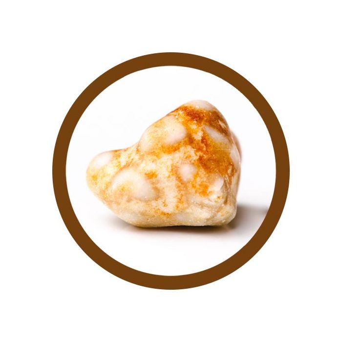 Gallstone real image