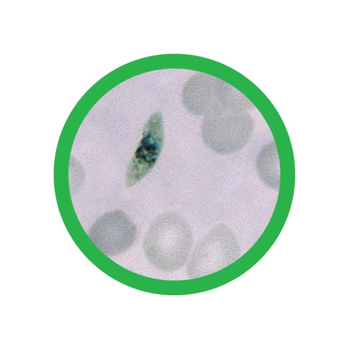 Malaria microbial