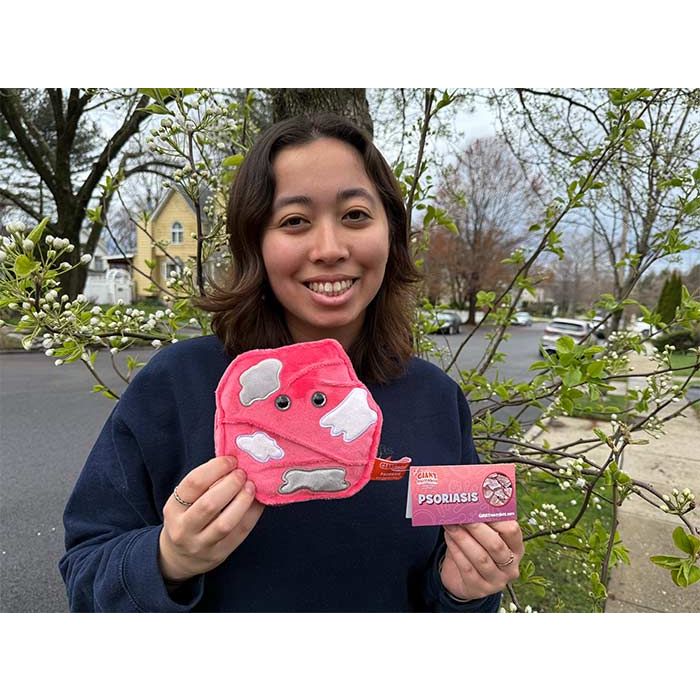 Model with Psoriasis plush
