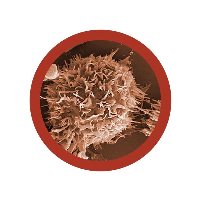 Kidney Cancer microbial