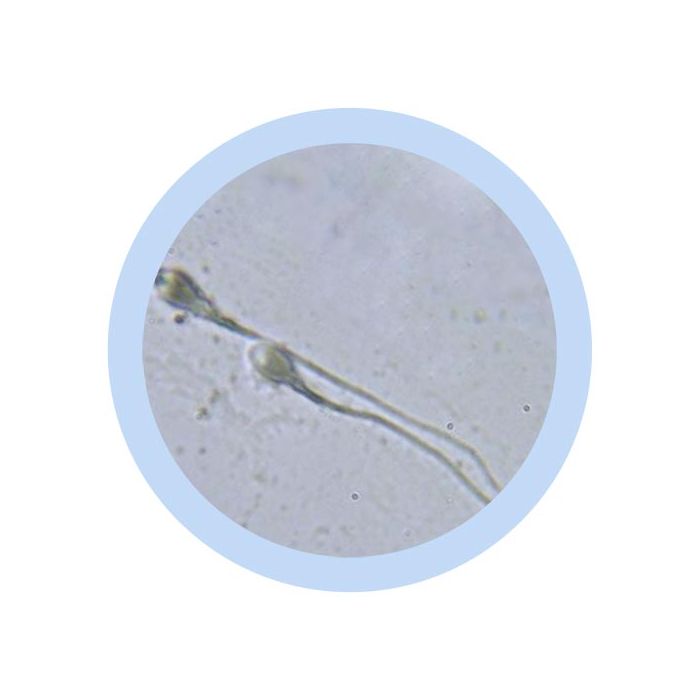 Sperm microbial