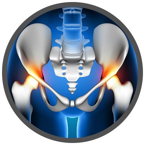 Hip Replacement micro